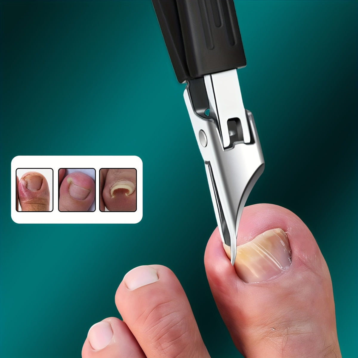 Thick Ingrown Nails Heavy Duty Stainless Steel Trimmer